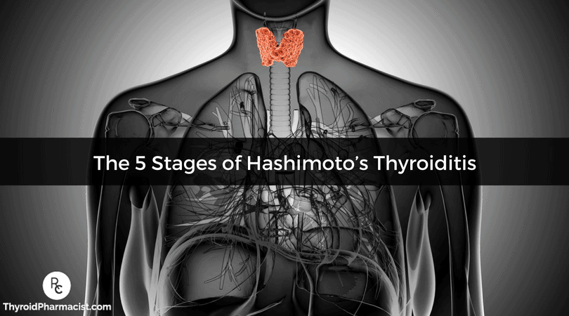 The 5 Stages of Hashimoto’s Thyroiditis