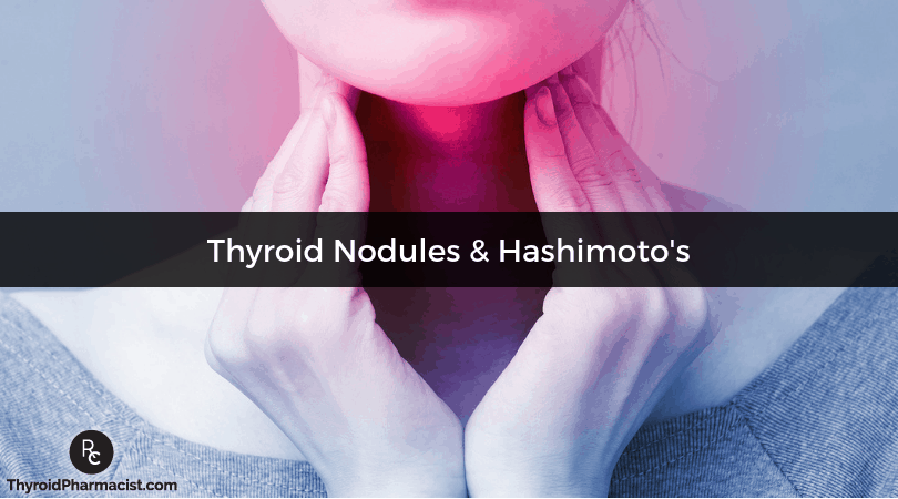 Nodules & Hashimoto's